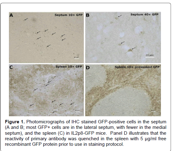 alzheimers-disease-parkinsonism-GFP-positive