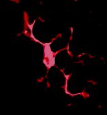 alzheimers-disease-parkinsonism-Resting-microglia