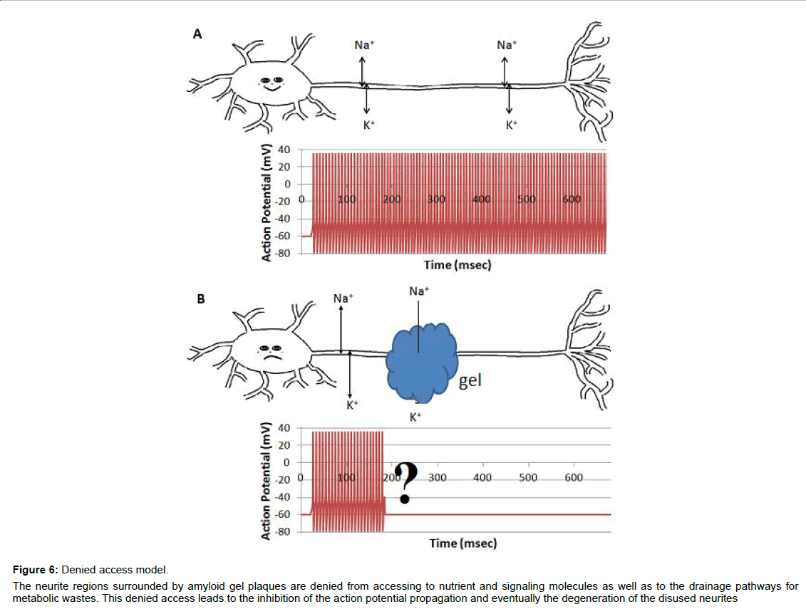 alzheimers-disease-parkinsonism-action-potential