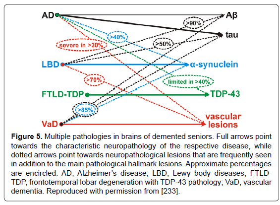 alzheimers-disease-parkinsonism-hallmark-lesions