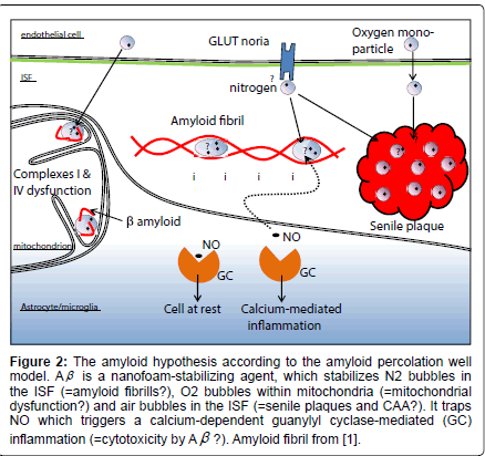 alzheimers-disease-parkinsonism-normal-cell