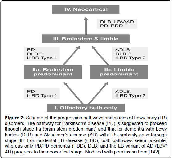 alzheimers-disease-parkinsonism-progression-pathways