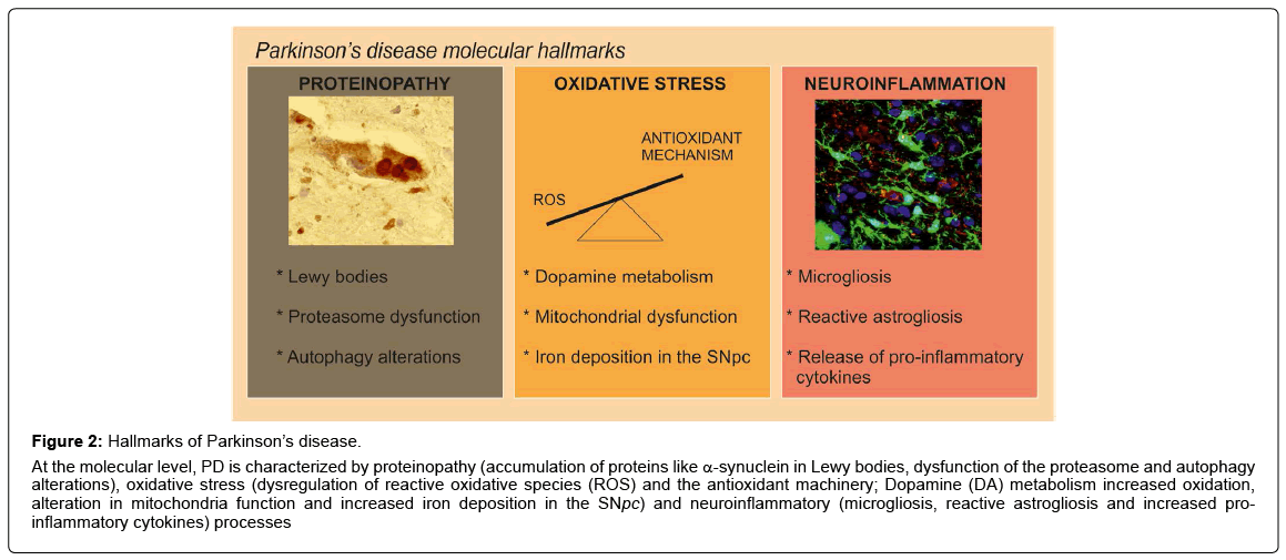 alzheimers-disease-parkinsonism-proteinopathy