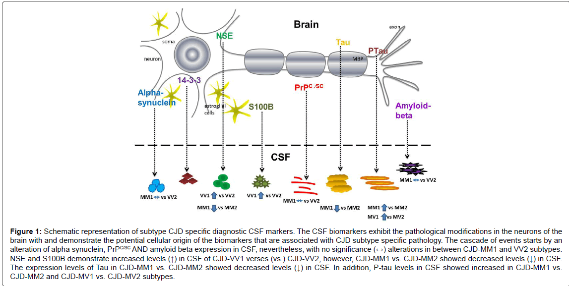 alzheimers-disease-parkinsonism-specific-pathology