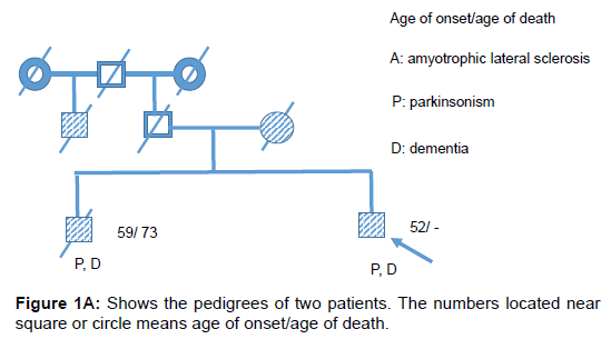 alzheimers-disease-parkinsonism-two-patients