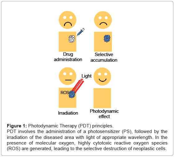 analytical-bioanalytical-techniques-Photodynamic-Therapy-principles