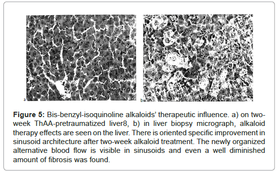 analytical-bioanalytical-techniques-benzyl-isoquinoline-therapeutic