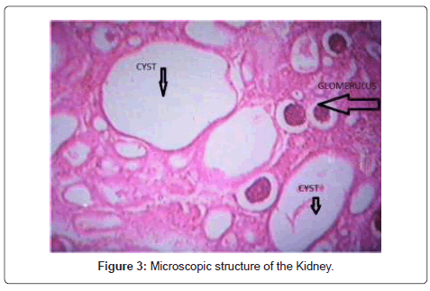 microscopic inversus totalis anatomical