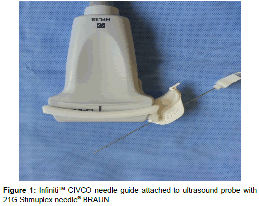 Anesthesia-clinical-research-CIVCO-needle-guide