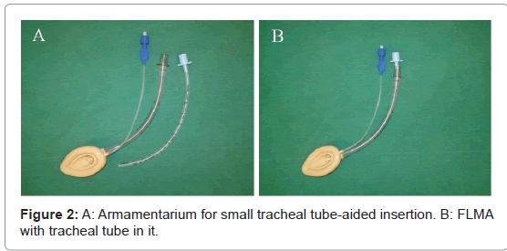 anesthesia-clinical-tracheal-tube