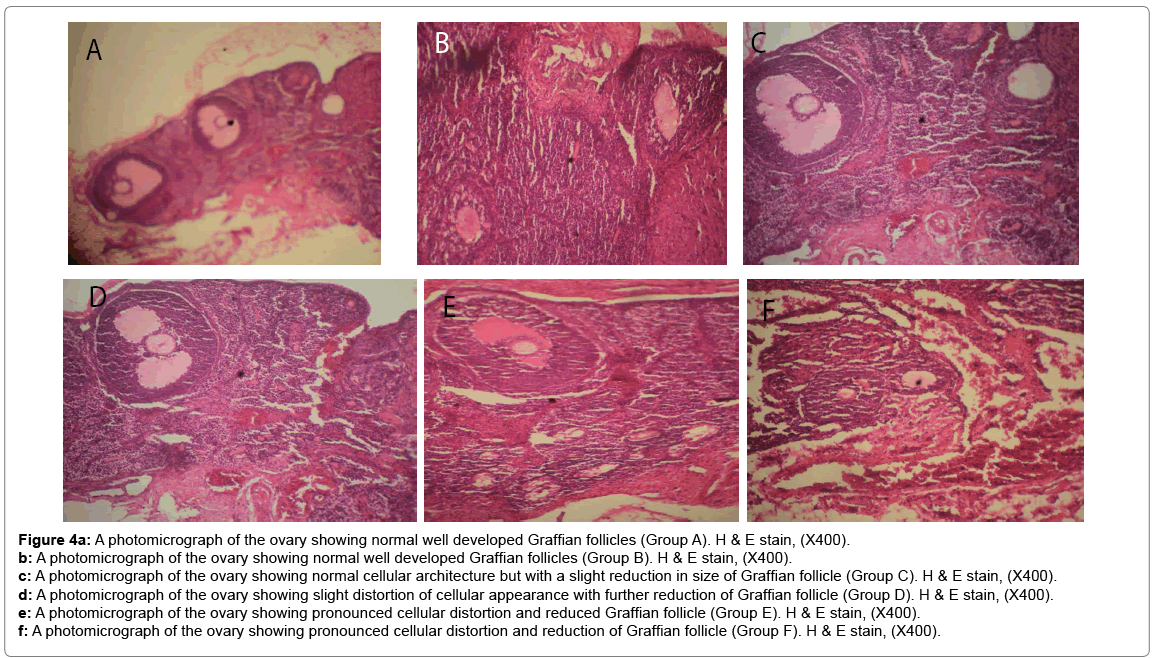 biochemistry-physiology-Graffian-follicles