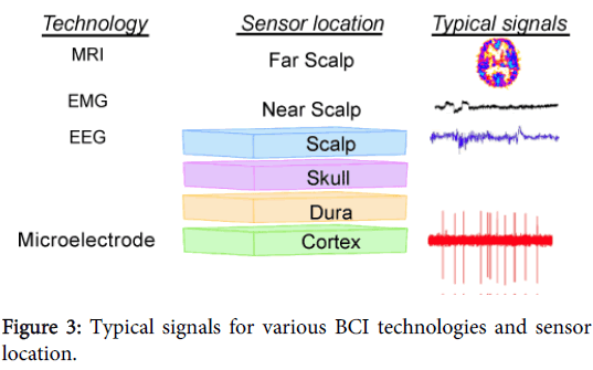 A Brief Review Of Brain Signal Monitoring Technologies For - 