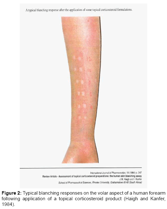 Bioequivalence-bioavailability-corticosteroid