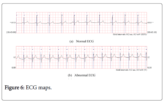 biology-medicine-ECG-maps