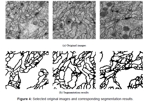 biomimetics-biomaterials-tissue-engineering-corresponding-segmentation-results