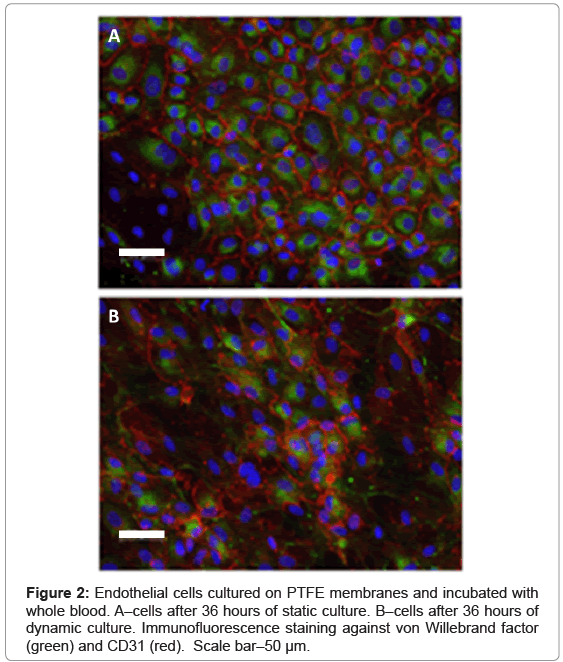 biotechnology-biomaterials-Endothelial-cells