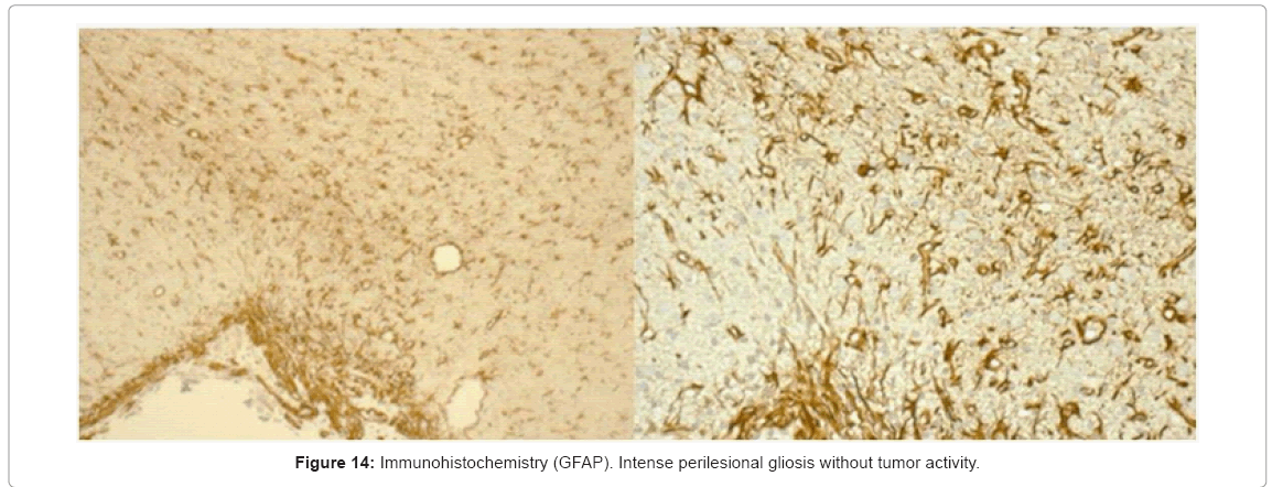 biotechnology-biomaterials-Immunohistochemistry