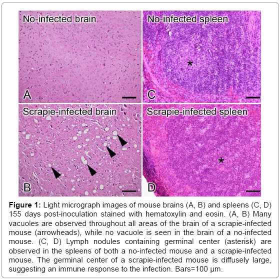 biotechnology-biomaterials-Lymph-nodules