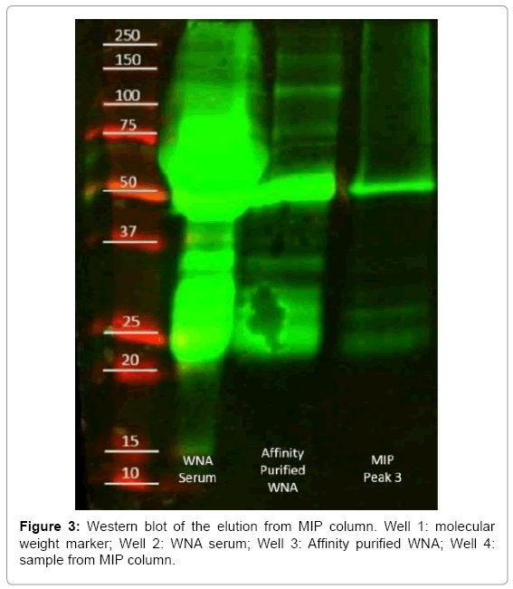 biotechnology-biomaterials-MIP-column