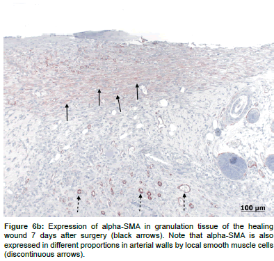 biotechnology-biomaterials-granulation-tissue