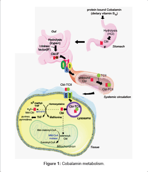 Blood-disorders-transfusion-cobalamin-metabolism