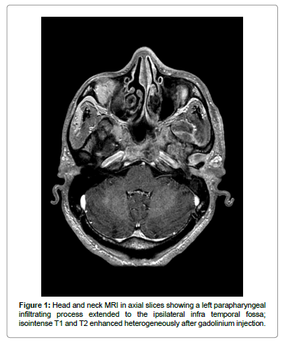 Cancer Of The Head And Neck Myers Pdf Download