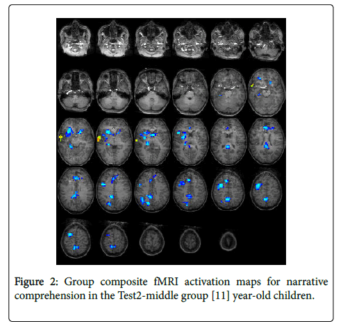 child-adolescent-childrens-activation