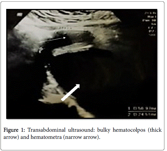 child-health-Transabdominal-ultrasound