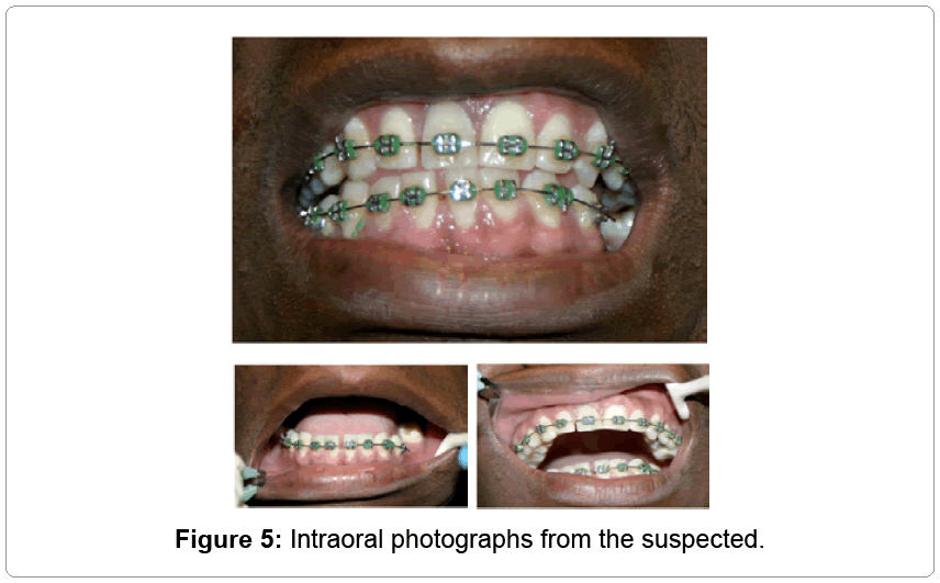 civil-legal-sciences-Intraoral-photographs