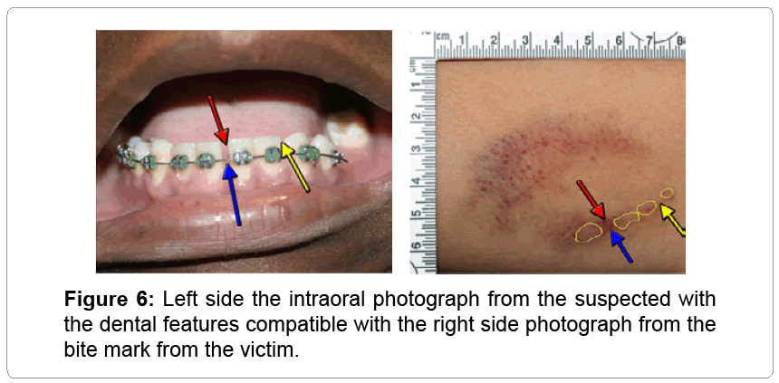 civil-legal-sciences-dental-features