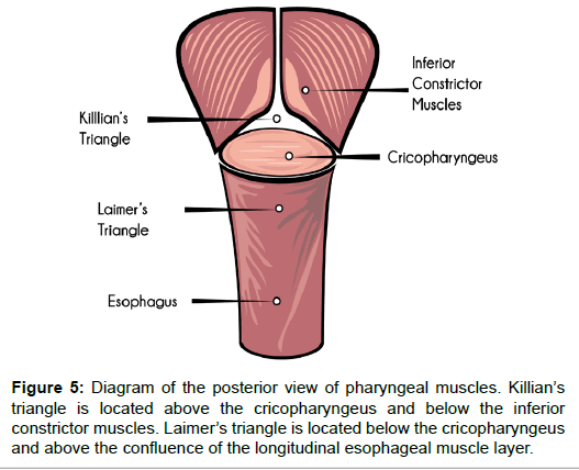 insertion of inferior pharyngeal constrictor muscle