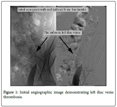 clinical-diagnosis-research-Initial-angiographic-image