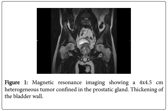 clinical-diagnosis-research-Magnetic-resonance-imaging