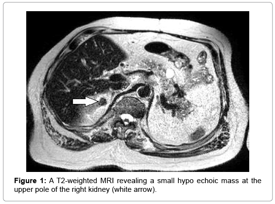 clinical-diagnosis-research-T2-weighted-MRI