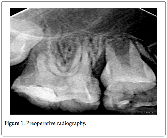 clinical-diagnosis-research-preoperative-radiography