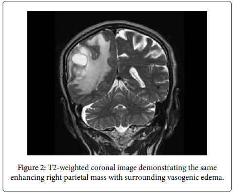 clinical-experimental-coronal