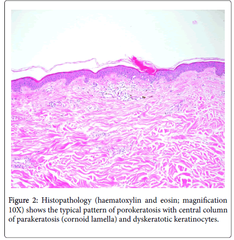 clinical-experimental-dermatology-Histopathology