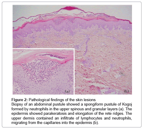 clinical-experimental-dermatology-Pathological-findings