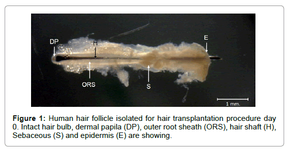 clinical-experimental-dermatology-hair-transplantation