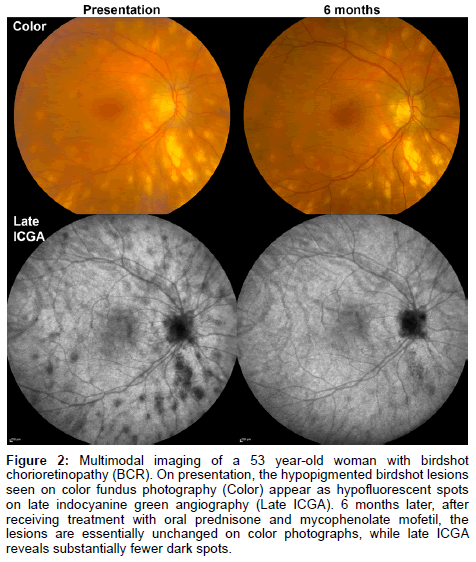 clinical-experimental-ophthalmology-Multimodal-imaging-53-year-old-woman