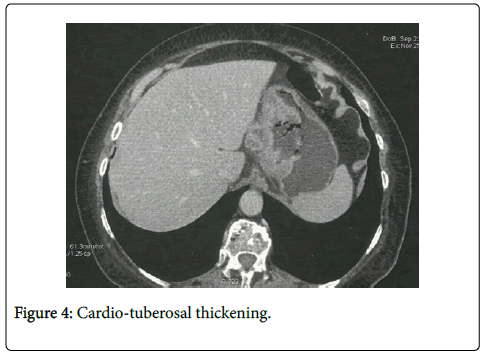 clinical-experimental-pathology-Cardio-tuberosal