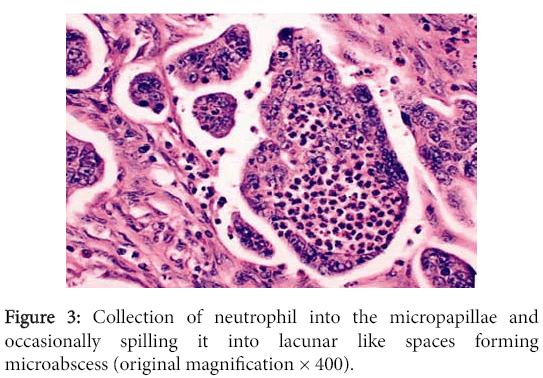 clinical-experimental-pathology-Collection-neutrophil