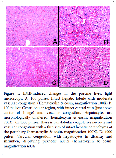 clinical-experimental-pathology-Intact-hepatic