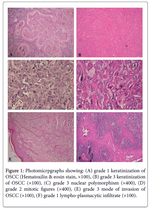clinical-experimental-pathology-Photomicrpgraphs