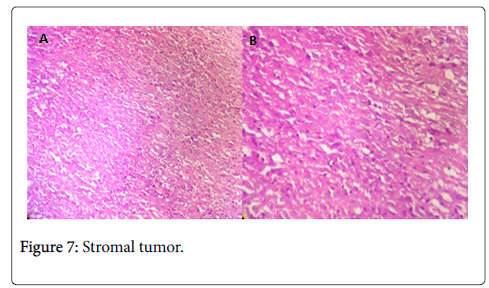 clinical-experimental-pathology-Stromal