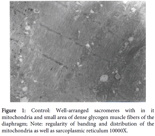 clinical-experimental-pathology-Well-arranged-sacromeres