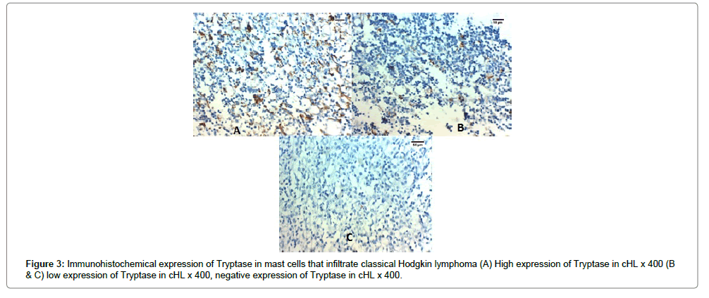 clinical-experimental-pathology-infiltrate-classical