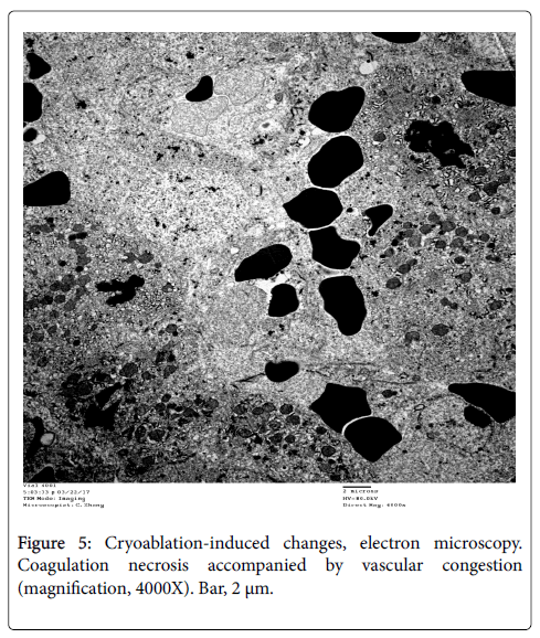 clinical-experimental-pathology-vascular-congestion