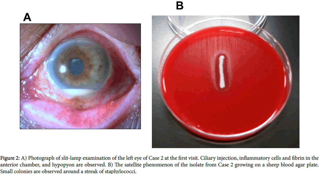 clinical-experimental-slit-lamp-examination