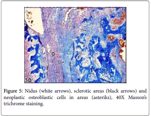 clinical-experimental-trichrome-neoplastic